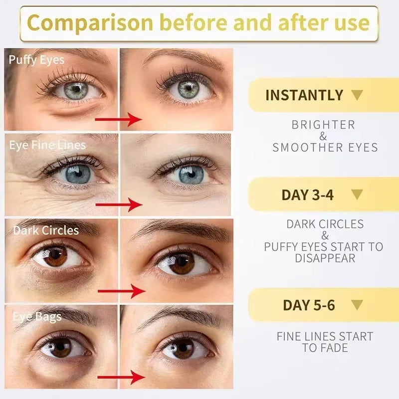 Instant Eye Bag Removal Cream – Retinol Anti-Wrinkle & Brightening Care
