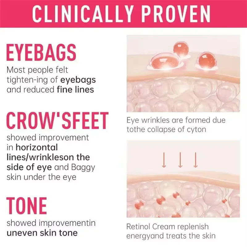 Instant Eye Bag Removal Cream – Retinol Anti-Wrinkle & Brightening Care