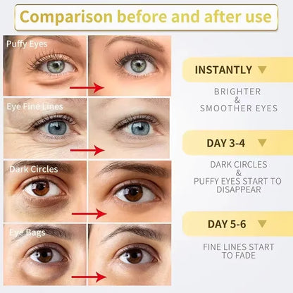 Instant Eye Bag Removal Cream – Retinol Anti-Wrinkle & Brightening Care